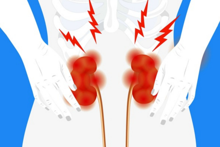 Bổ can thận – giải pháp nền tảng cho các bệnh xương khớp
