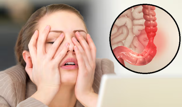 Sự thật ít người biết về viêm đại tràng và cách kiểm soát hiệu quả