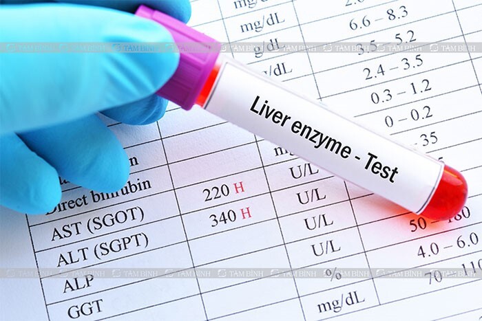 Hạ men gan tự nhiên bằng thảo dược: giải độc gan, phục hồi chức năng