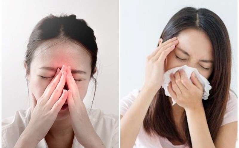 Phân tích toàn diện các loại viêm xoang và nguyên tắc điều trị