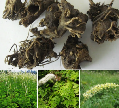 Đau trĩ uống thuốc gì? Phân tích chi tiết các nhóm thuốc điều trị