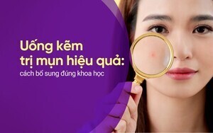 Uống kẽm trị mụn hiệu quả: cách bổ sung đúng khoa học