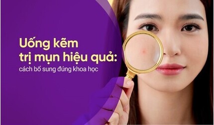 Uống kẽm trị mụn hiệu quả: cách bổ sung đúng khoa học