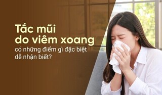 Tắc mũi do viêm xoang có những điểm gì đặc biệt dễ nhận biết?