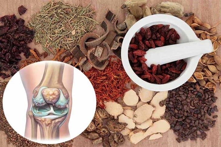 Bài thuốc Đông y chữa xương khớp, đau lưng, đau đầu gối phong tê thấp
