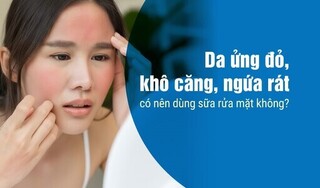 Da ửng đỏ, khô căng, ngứa rát có nên dùng sữa rửa mặt không?