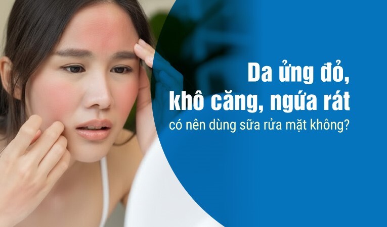 Da ửng đỏ, khô căng, ngứa rát có nên dùng sữa rửa mặt không?