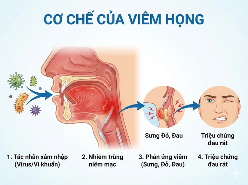 Viêm họng dùng Xịt họng Nhất Nhất có được không? Có tốt không?
