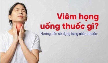 Viêm họng uống thuốc gì? Hướng dẫn sử dụng từng nhóm thuốc