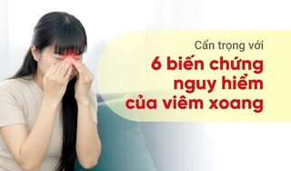 Cẩn trọng với 6 biến chứng nguy hiểm của viêm xoang
