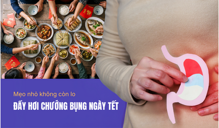 Mẹo nhỏ không còn lo đầy hơi chướng bụng ngày Tết