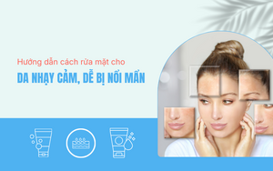 Hướng dẫn cách rửa mặt cho da nhạy cảm, dễ bị nổi mẩn