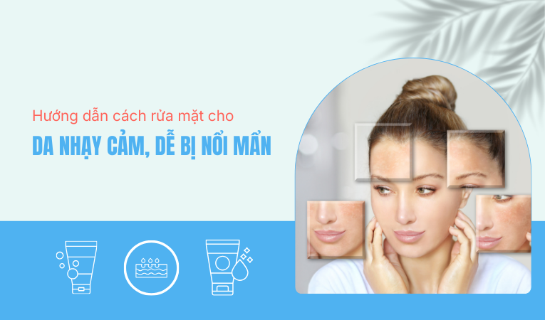 Hướng dẫn cách rửa mặt cho da nhạy cảm, dễ bị nổi mẩn