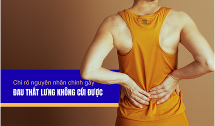Chỉ rõ nguyên nhân chính gây đau thắt lưng không cúi được