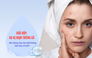 Giải đáp Da bị mụn trứng cá nên dùng sữa rửa mặt không bọt hay có bọt