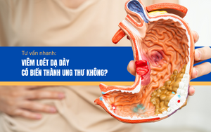 Tư vấn nhanh: Viêm loét dạ dày có biến thành ung thư không?