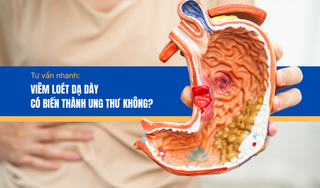 Tư vấn nhanh: Viêm loét dạ dày có biến thành ung thư không?