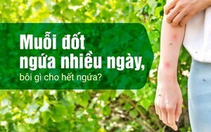 Muỗi đốt ngứa nhiều ngày, bôi gì cho hết ngứa?