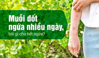 Muỗi đốt ngứa nhiều ngày, bôi gì cho hết ngứa?