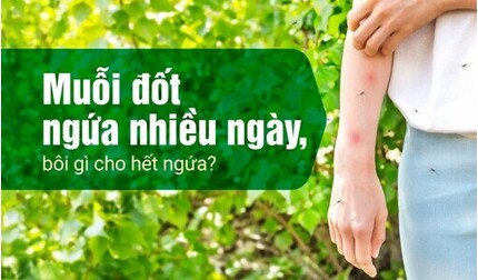 Muỗi đốt ngứa nhiều ngày, bôi gì cho hết ngứa?