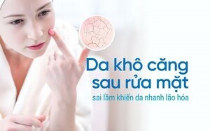 Da khô căng sau rửa mặt - sai lầm khiến da nhanh lão hóa
