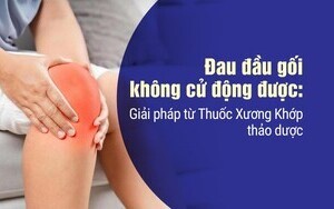 Đau đầu gối không cử động được: Giải pháp Thuốc Xương Khớp thảo dược