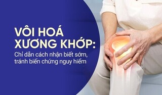 Vôi hoá xương khớp: Chỉ dẫn cách nhận biết sớm, tránh biến chứng