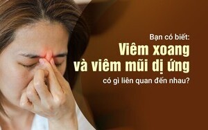 Bạn có biết: Viêm xoang và viêm mũi dị ứng có gì liên quan đến nhau?