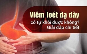 Viêm loét dạ dày có tự khỏi được không? Giải đáp chi tiết
