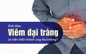 Giải đáp: Viêm đại tràng có tiến triển thành ung thư không?