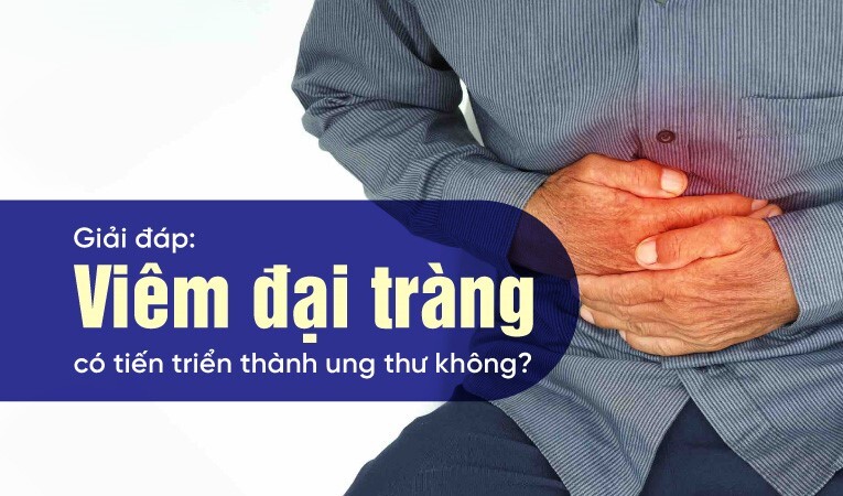 Giải đáp: Viêm đại tràng có tiến triển thành ung thư không?