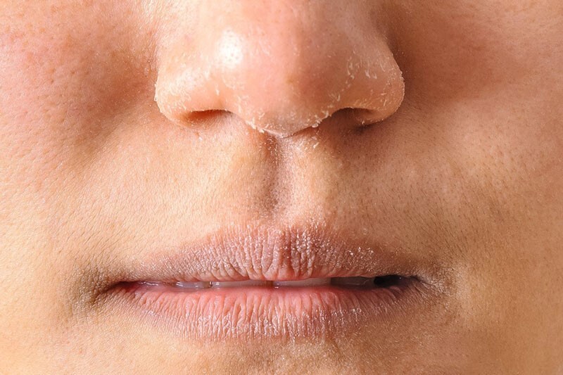 "Hồi sinh" cho làn da khô ráp: Không khó như bạn nghĩ!