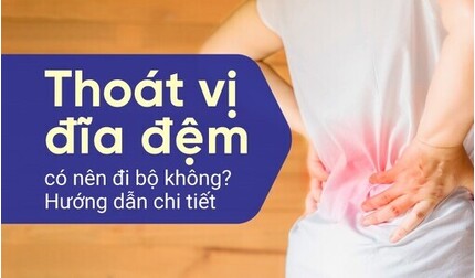 Thoát vị đĩa đệm có nên đi bộ không? Hướng dẫn chi tiết
