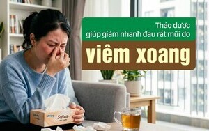 Thảo dược giúp giảm nhanh đau rát mũi do viêm xoang