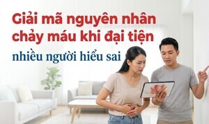 Giải mã nguyên nhân chảy máu khi đại tiện: nhiều người hiểu sai