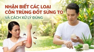 Nhận biết các loại côn trùng đốt sưng to và cách xử lý đúng