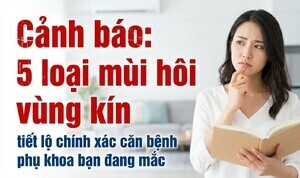 Cảnh báo: 5 loại mùi hôi vùng kín tiết lộ chính xác căn bệnh phụ khoa
