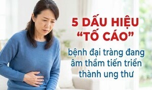 5 dấu hiệu 