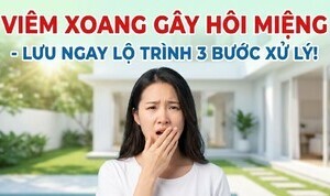 Viêm xoang gây hôi miệng - lưu ngay lộ trình 3 bước xử lý!