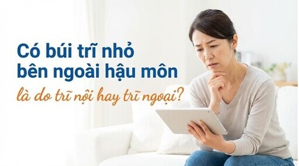 Có búi trĩ nhỏ bên ngoài hậu môn là do trĩ nội hay trĩ ngoại?