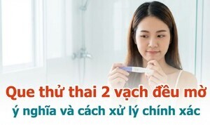 Que thử thai 2 vạch đều mờ: ý nghĩa và cách xử lý chính xác