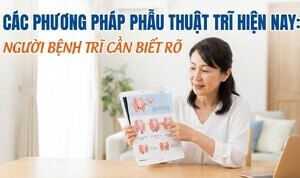 Các phương pháp phẫu thuật trĩ hiện nay: người bệnh trĩ cần biết rõ