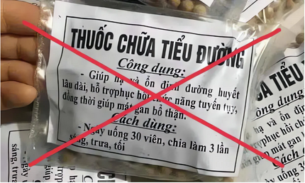 Mặt tròn xoe, suy yếu sau khi dùng thuốc không rõ nguồn gốc để 