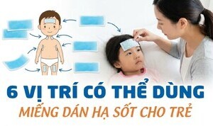 6 vị trí có thể dùng miếng dán hạ sốt cho trẻ