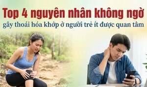 Top 4 nguyên nhân không ngờ gây thoái hóa khớp ở người trẻ