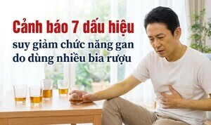 Cảnh báo 7 dấu hiệu suy giảm chức năng gan do dùng nhiều bia rượu