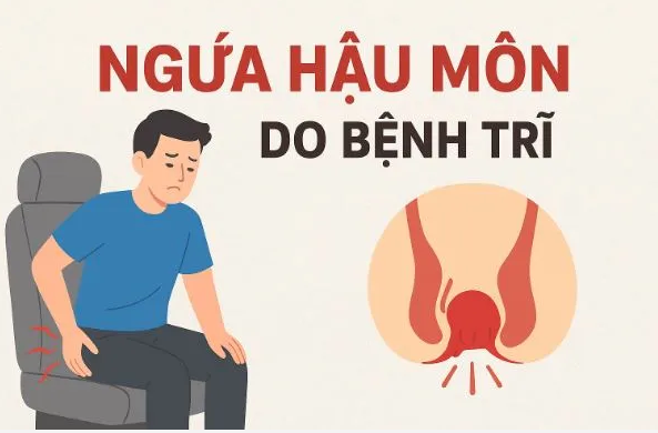 Bị ngứa hậu môn liên tục - những hậu quả khó lường
