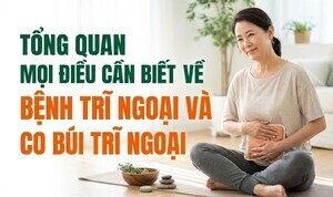 Tổng quan mọi điều cần biết về bệnh trĩ ngoại và co búi trĩ ngoại
