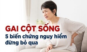 Gai cột sống: 5 biến chứng nguy hiểm đừng bỏ qua