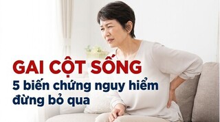 Gai cột sống: 5 biến chứng nguy hiểm đừng bỏ qua